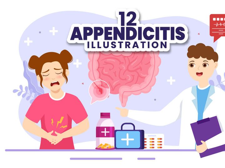 12 Appendicitis Inflammation Illustration