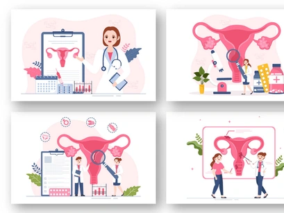 13 Endometriosis Illustration