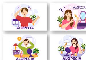 11 Alopecia Hair Loss Illustration