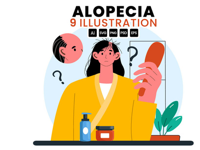 9 Alopecia Hair Loss Illustration