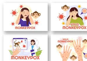 12 Monkeypox Outbreak Illustration