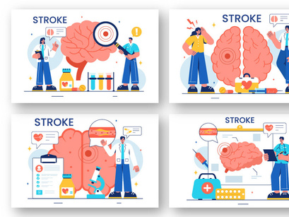 12 Human Brain Stroke Illustration