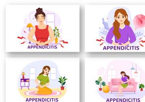 12 Appendicitis Inflammation Illustration