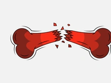 Broken Bone. Bone Fracture. Cute Dog Crack and Splint Bones. Dangerous Situation by Trauma to the Body. Vector Illustration for T Shirt Design and Other Usages.