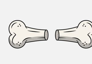Broken Bone. Bone Fracture. Cute Dog Crack and Splint Bones. Dangerous Situation by Trauma to the Body. Vector Illustration for T Shirt Design and Other Usages.