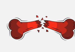 Broken Bone. Bone Fracture. Cute Dog Crack and Splint Bones. Dangerous Situation by Trauma to the Body. Vector Illustration for T Shirt Design and Other Usages.