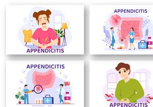 12 Appendicitis Inflammation Illustration