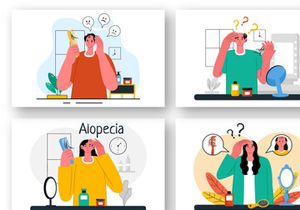 9 Alopecia Hair Loss Illustration