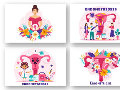 12 Endometriosis Illustration