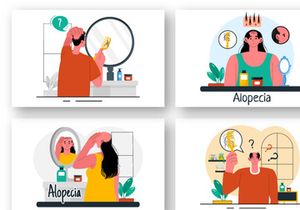 9 Alopecia Hair Loss Illustration