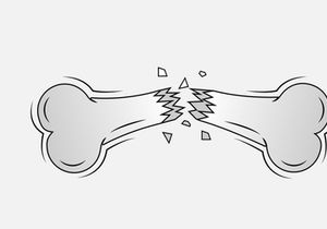 Broken Bone. Bone Fracture. Cute Dog Crack and Splint Bones. Dangerous Situation by Trauma to the Body. Vector Illustration for T Shirt Design and Other Usages.