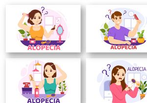 11 Alopecia Hair Loss Illustration