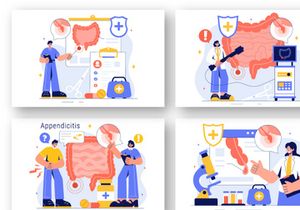 9 Appendicitis Inflammation Illustration