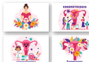 12 Endometriosis Illustration
