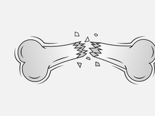 Broken Bone. Bone Fracture. Cute Dog Crack and Splint Bones. Dangerous Situation by Trauma to the Body. Vector Illustration for T Shirt Design and Other Usages.