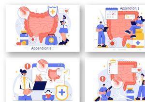 9 Appendicitis Inflammation Illustration