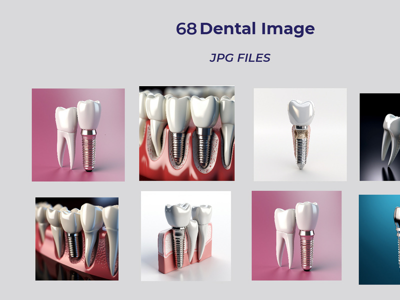 Dental implant and teeth with Aİ image